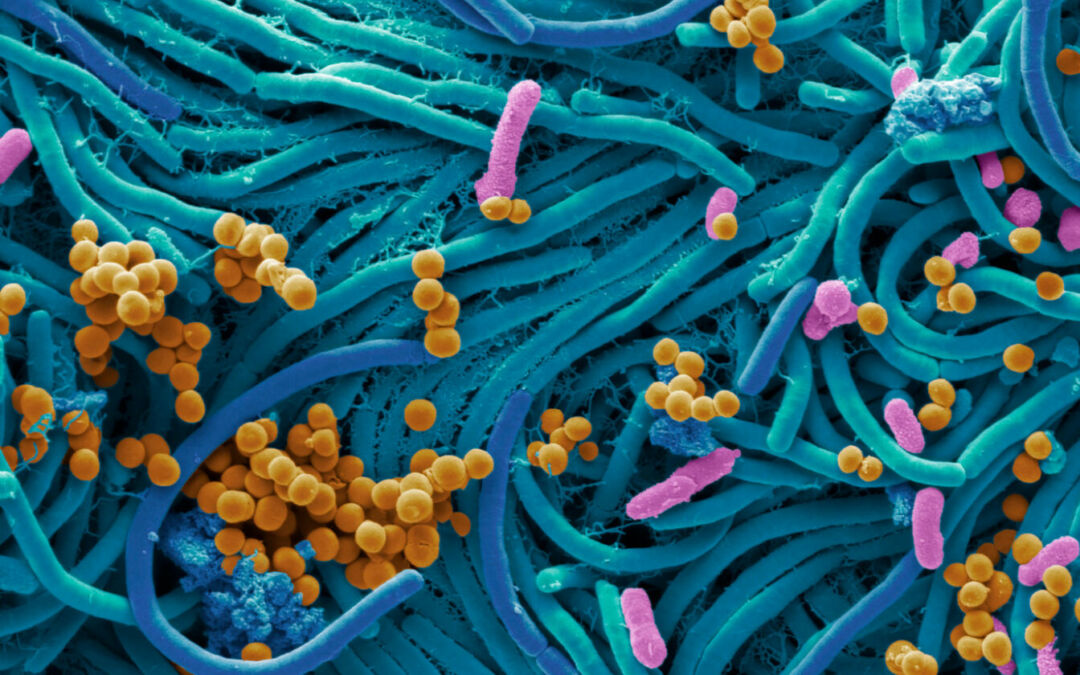 Attività fisica e microbiota intestinale: una relazione da indagare